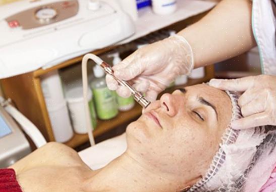 Το Microdermabrasion λειτουργεί καλύτερα για μικρές παθήσεις του δέρματος