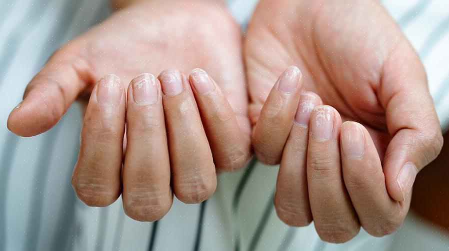 Αυτό θα μειώσει την ανάγκη σας για χρήση ενός αφαίρεσης βερνικιού νυχιών που μπορεί να προκαλέσει