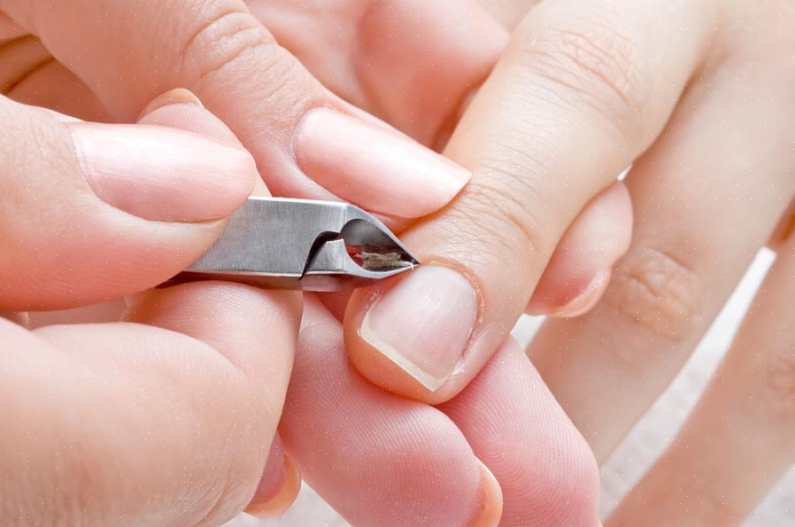 Αυτό δεν θα αποτρέψει μόνο το hangnail